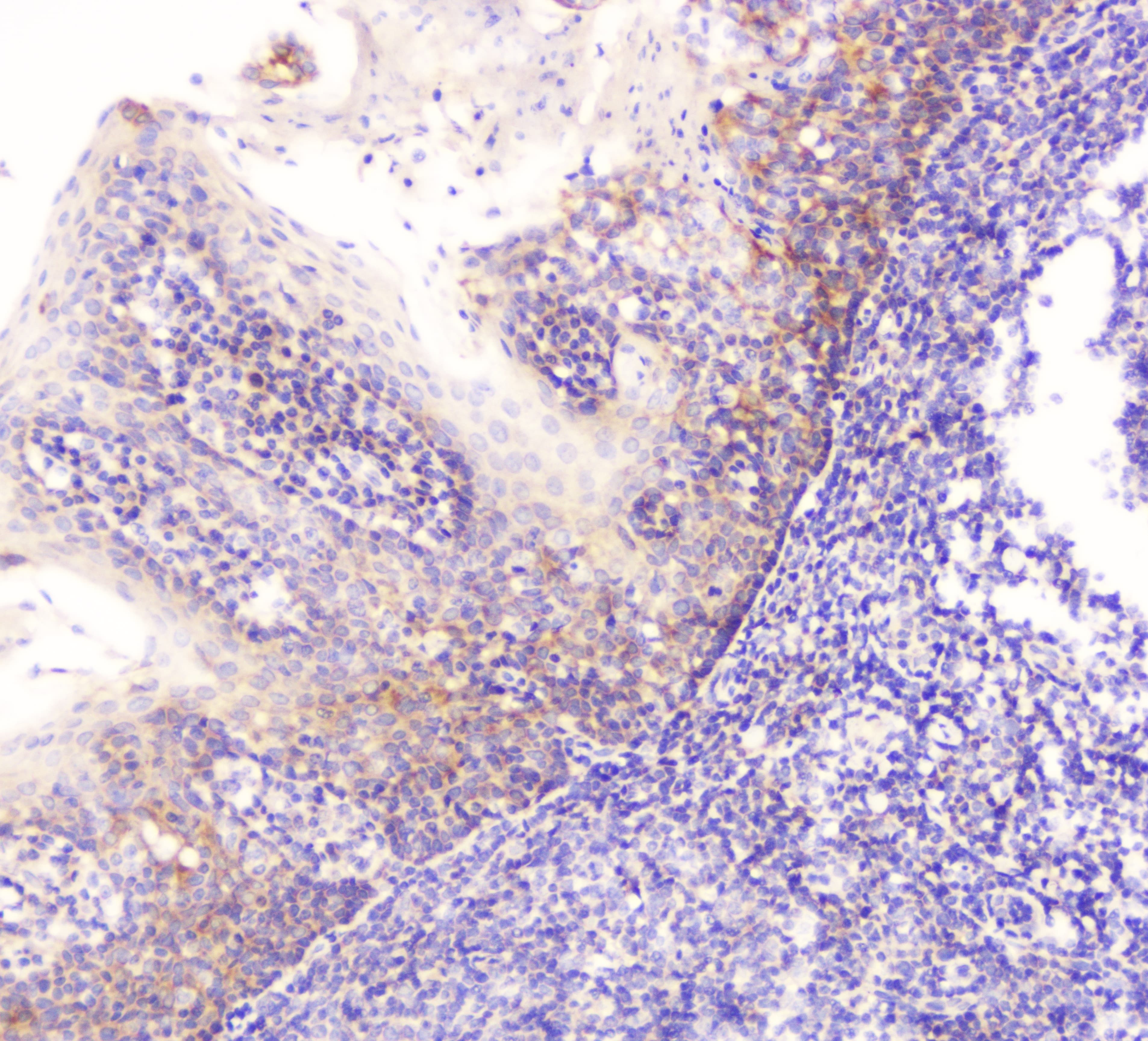 Polyclonal Rabbit anti-Human EML4 Antibody (IHC, WB)