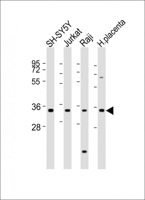 RASSF2 Antibody (aa123-156)