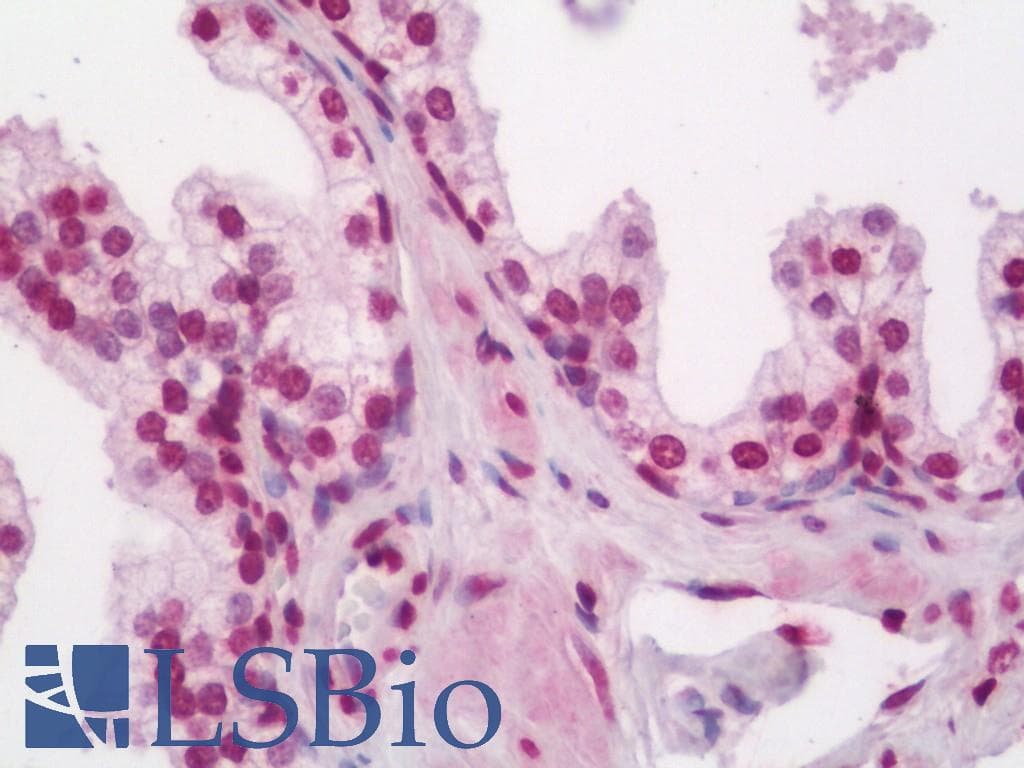IHC-plus™ Polyclonal Rabbit anti-Human ELF5 Antibody (aa191-240, IHC, WB)