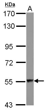DARS Antibody
