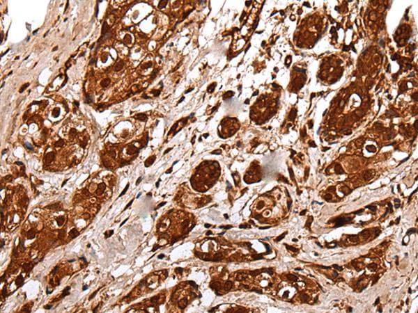 Polyclonal Rabbit anti-Human UEV1 / UEV1A Antibody (IHC, WB)
