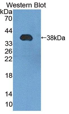 PMM1 Antibody (aa2-262, Biotin)