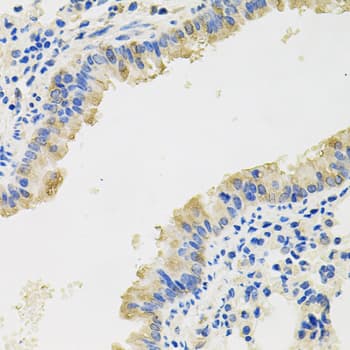 Polyclonal Rabbit anti-Human IL8 / Interleukin 8 Antibody (IHC, WB)
