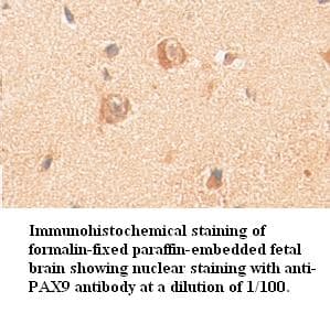 PAX9 Antibody (Internal)