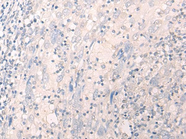 LILRA2 / CD85h / ILT1 Antibody