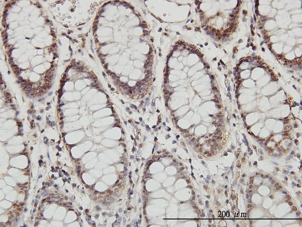 PSMB8 / LMP7 Antibody (clone 1B3)