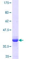 Human SLC20A2 / PIT2 Protein (Recombinant GST, N-terminus)