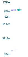 Human PRKRA / PACT Protein (Recombinant GST)