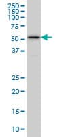Monoclonal Mouse anti-Human ZPR1 / ZNF259 Antibody (clone 6F7, IHC, WB)