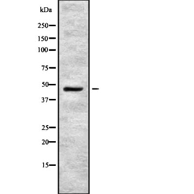 ENTPD5 / CD39L4 Antibody