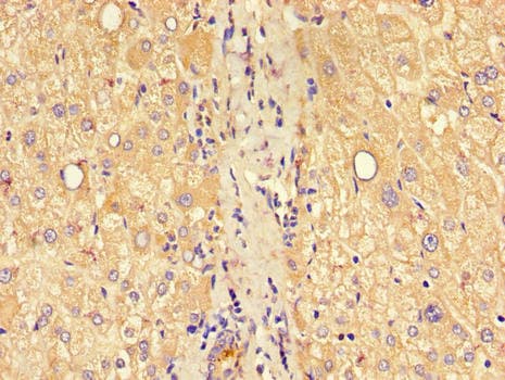 CLDN1 / Claudin 1 Antibody