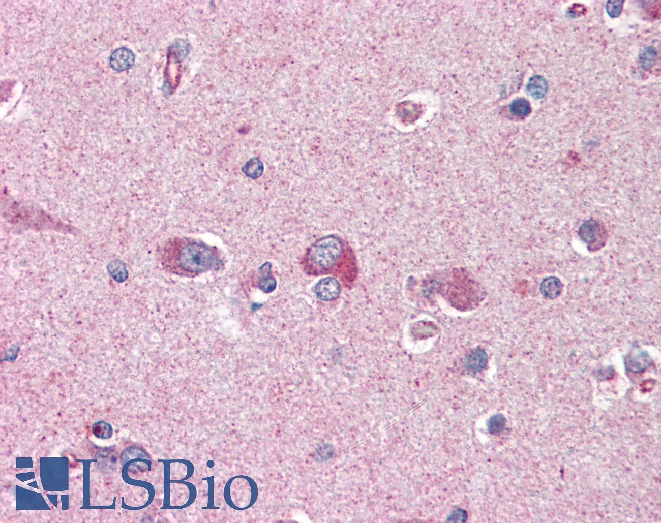IHC-plus™ Polyclonal Goat anti-Human PAFAH1B1 / LIS1 Antibody (aa397-410, IHC, WB)