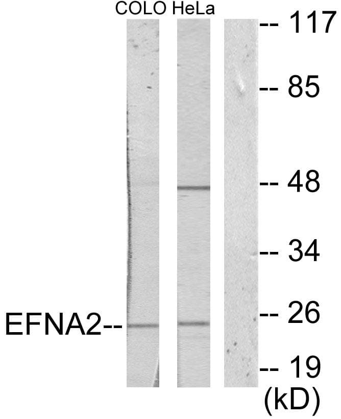 EFNA2 / Ephrin A2 Antibody
