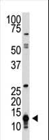 SUMO Antibody (aa37-66)