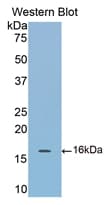 Polyclonal Rabbit anti-Mouse COMP / THBS5 Antibody (aa40-180, WB)