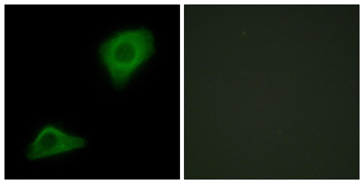 Polyclonal Rabbit anti-Human plcH Antibody (IF, WB)