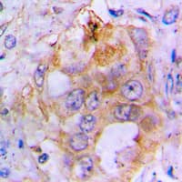 BMP3 Antibody (Internal)