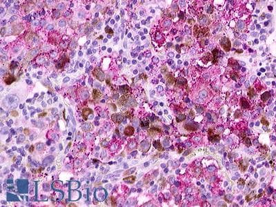 PathPlus™ GPR12 Antibody (Extracellular Domain)