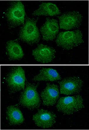VHL / Von Hippel Lindau Antibody (clone AT82B10)