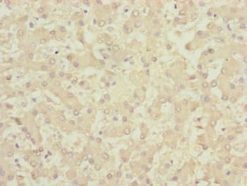 Polyclonal Rabbit anti-Human CENPK Antibody (IHC, WB)