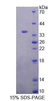Mouse Complement C8A Protein (Recombinant His-T7, N-terminus)