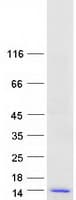 Human VKORC1 Protein (Recombinant Myc-DDK (Flag))