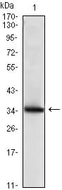 SCGB2A2 / Mammaglobin A Antibody (clone 3C8)