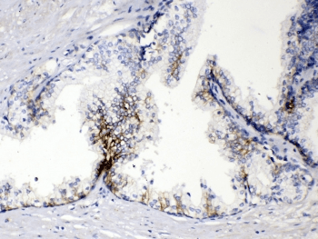 EPCAM Antibody