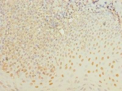 Polyclonal Rabbit anti-Human ZBTB6 Antibody (IHC, WB)