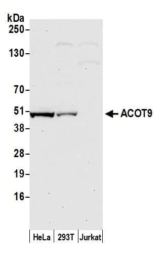 Polyclonal Rabbit anti-Human ACOT9 Antibody (aa200-250, WB)