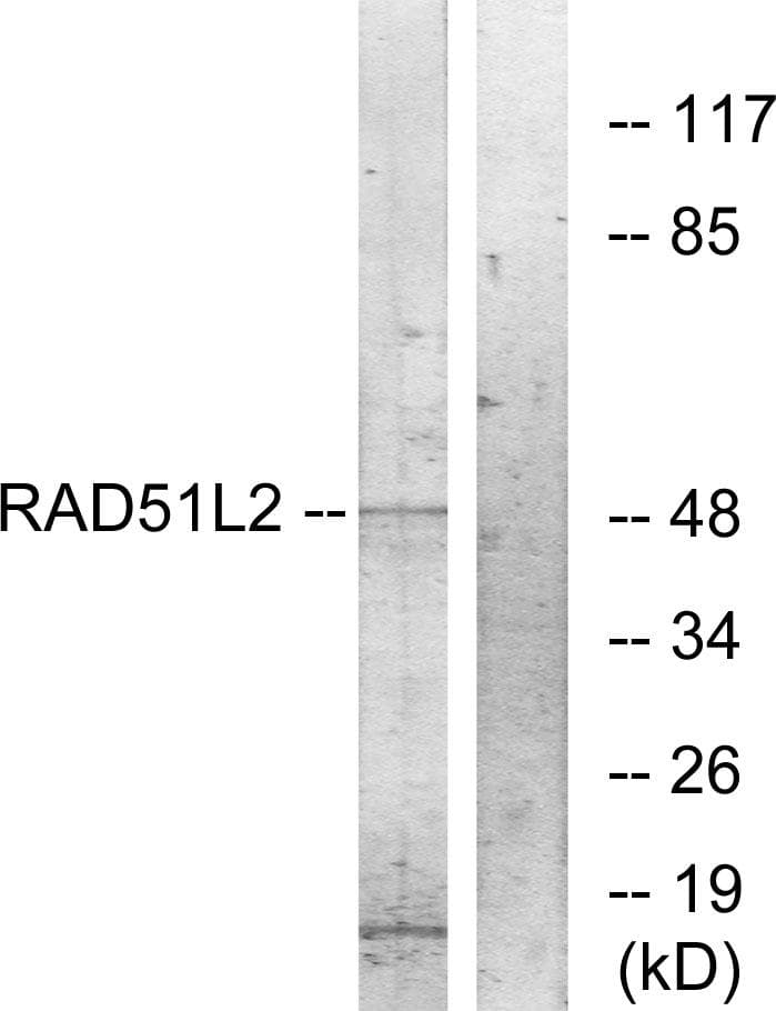 RAD51C Antibody