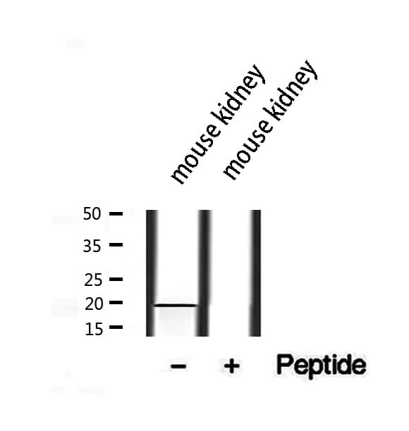 GREM2 / Gremlin 2 Antibody