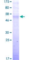 Human TERE1 / UBIAD1 Protein (Recombinant GST)