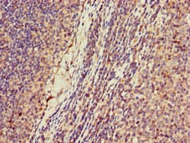 Polyclonal Rabbit anti-Human KIF2A Antibody (IHC)