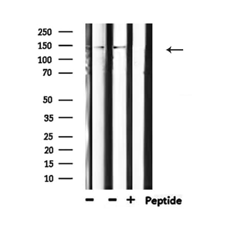 Polyclonal Rabbit anti-Human PLCG1 Antibody (phospho-Tyr771, IHC, IF, WB)