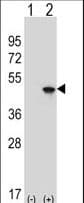 EIF4A2 Antibody (aa333-360)