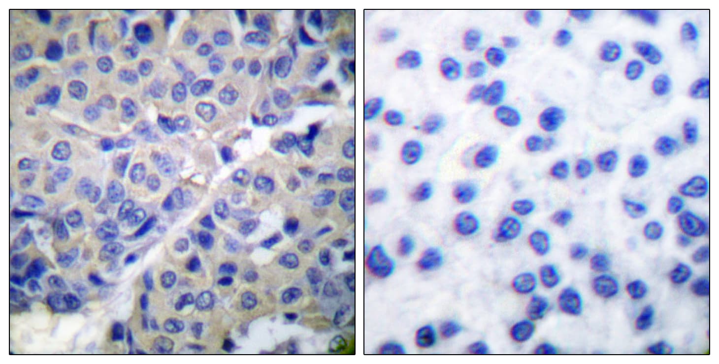 SYT1 / Synaptotagmin Antibody (phospho-Ser309)
