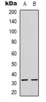 ATP5C1 Antibody (Internal)