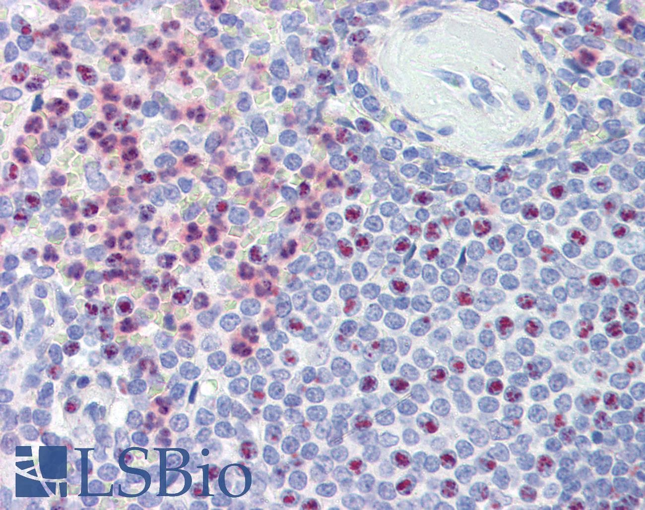 IHC-plus™ PKD1 / Polycystin Antibody (aa4289-4300)