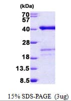 Human SURF2 / SURF-2 Protein (Recombinant His)