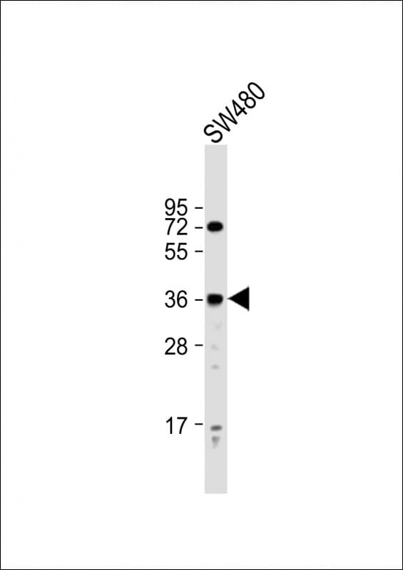 PRSS23 Antibody (aa156-191)