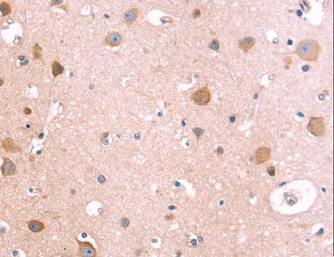 IL1RL1 Antibody