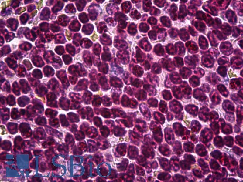 IHC-plus™ ATF6 Antibody (clone 3D5)