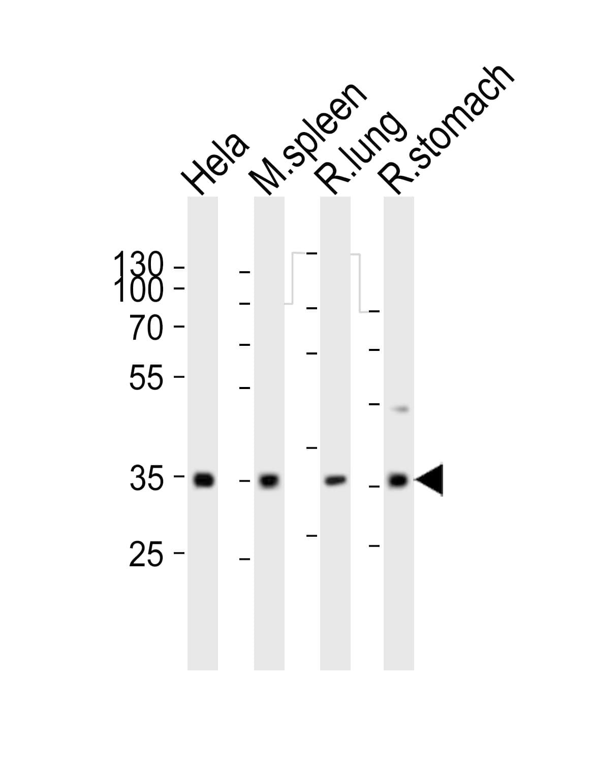 CCND3 / Cyclin D3 Antibody (aa33-66)