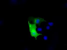TLDC1 / KIAA1609 Antibody (clone OTI12B1)