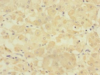 TMPRSS15 / Enterokinase Antibody
