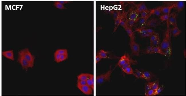 Ferritin Antibody (clone 321B7)