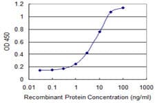 IHC-plus™ SMO / Smoothened Antibody (clone 3E5)