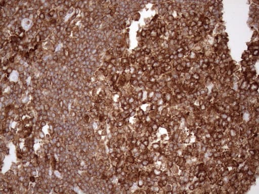 URP2 / FERMT3 Antibody (aa259-528, clone OTI3C7)