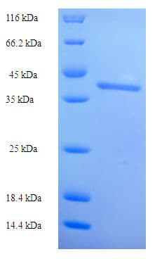 Human ISX Protein (Recombinant His)